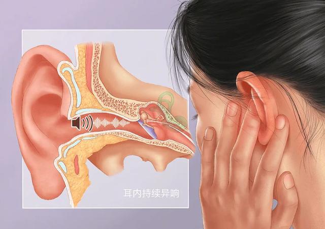 包含耳鸣声音办有电报声音是怎么回事的词条