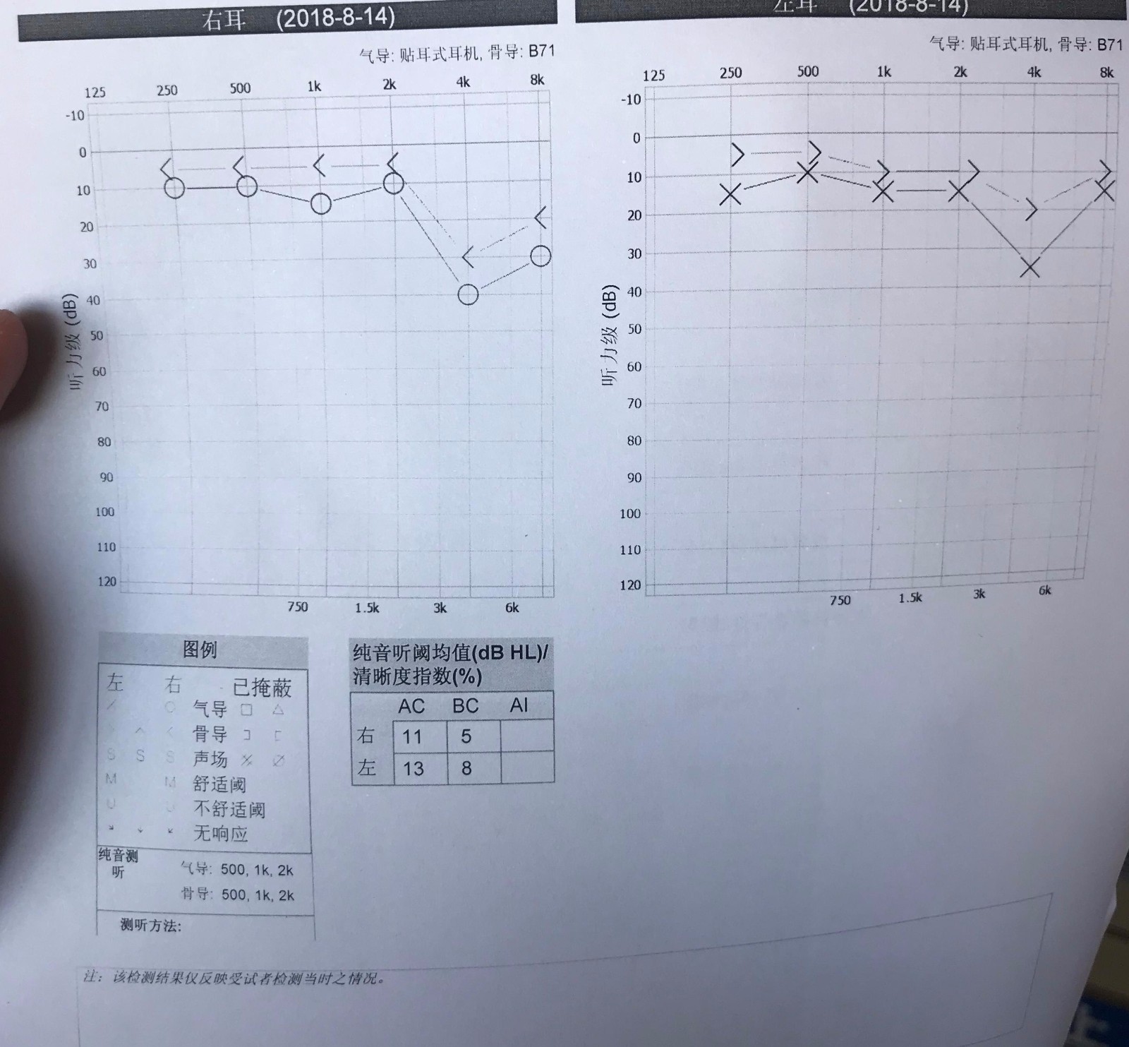 耳朵里有发电报的声音-耳朵里面有发电报的声音怎么回事