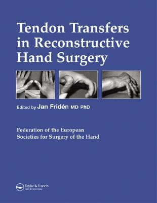 transfers-transfer双写吗