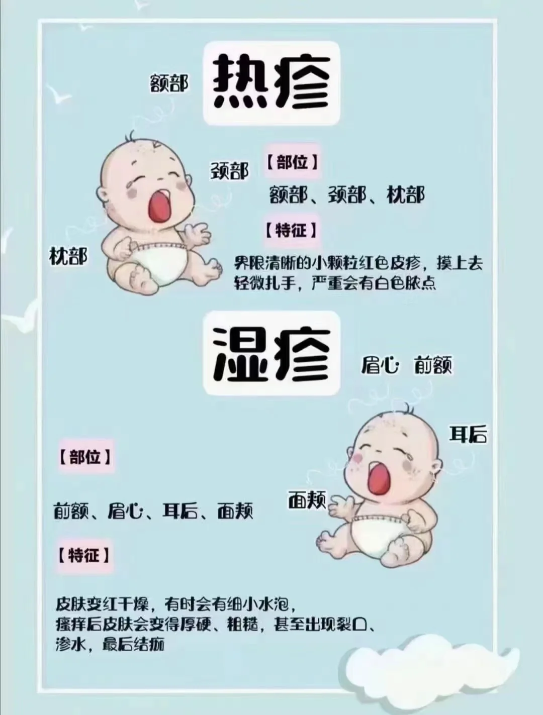 去除婴儿热疹小妙招_去除婴儿热疹小妙招图片